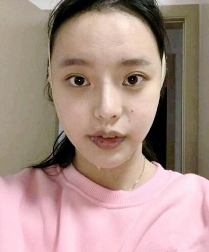 磨骨效果圖