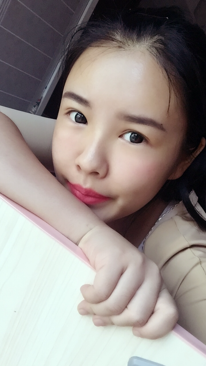 西安莎曼妃醫(yī)療美容醫(yī)院醫(yī)生樸俊做自體脂肪豐太陽(yáng)穴效果怎么樣？