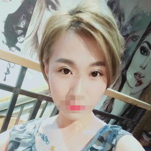 上海臻景醫(yī)療整形醫(yī)生李載成做雙眼皮怎么樣？李載成雙眼皮手術(shù)案例