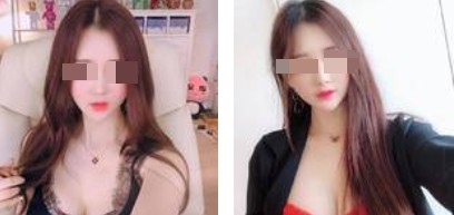 沈陽杏林整形美容醫(yī)院崔昌墉醫(yī)生做假體隆胸技術(shù)怎么樣？附案例