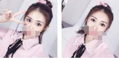 沒(méi)有了眼袋困擾，身體和心態(tài)都年輕了十歲