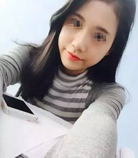做完膨體隆鼻，鼻子變“挺”了