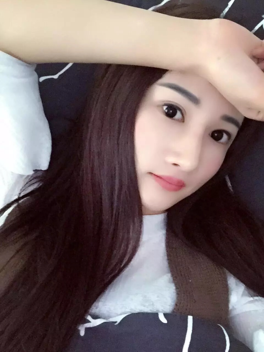廣州廣大整形醫(yī)生秦瑜做顴骨內推+下頜角整形怎么樣？附案例