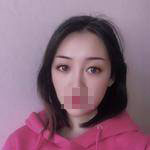 做完雙眼皮手術(shù)眼睛更加迷人了，眼睛自己會撩小哥哥