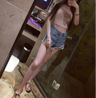 合肥壹加壹整形醫(yī)生周福田做腰腹吸脂技術怎么樣？附腰腹吸脂案例