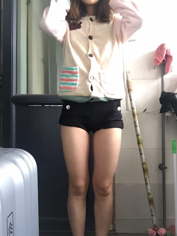 成都美立方整形醫(yī)院黃華醫(yī)生做大腿吸脂怎么樣？附大腿吸脂案例
