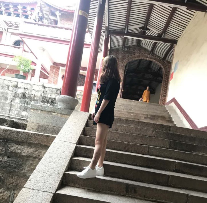 廣州軍頤醫(yī)院整形美容中心石建薇醫(yī)生腰腹吸脂真實(shí)案例對比圖