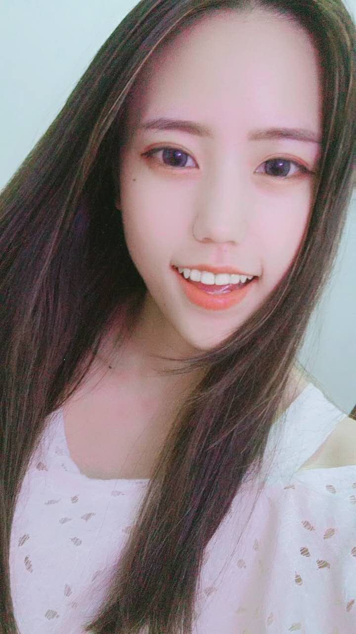 術后第七天，鼻子已經不腫了