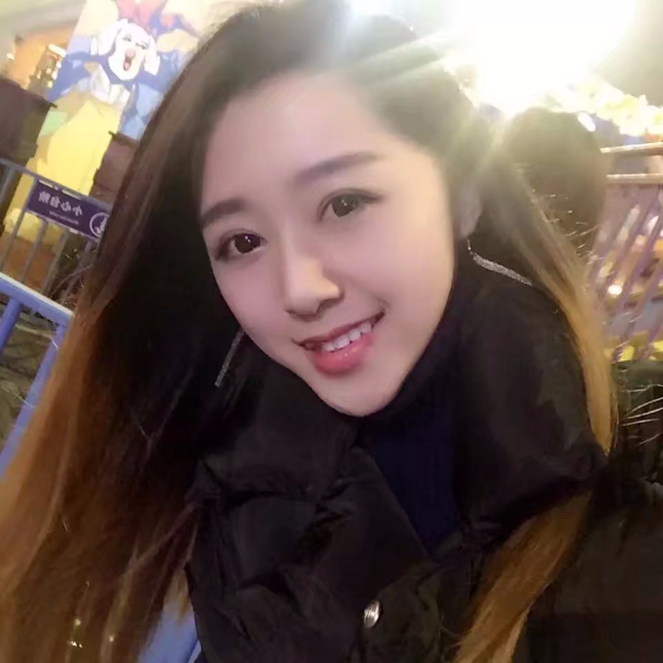西安米蘭柏羽整形醫(yī)院李旭平做切開雙眼皮效果怎么樣？附案例