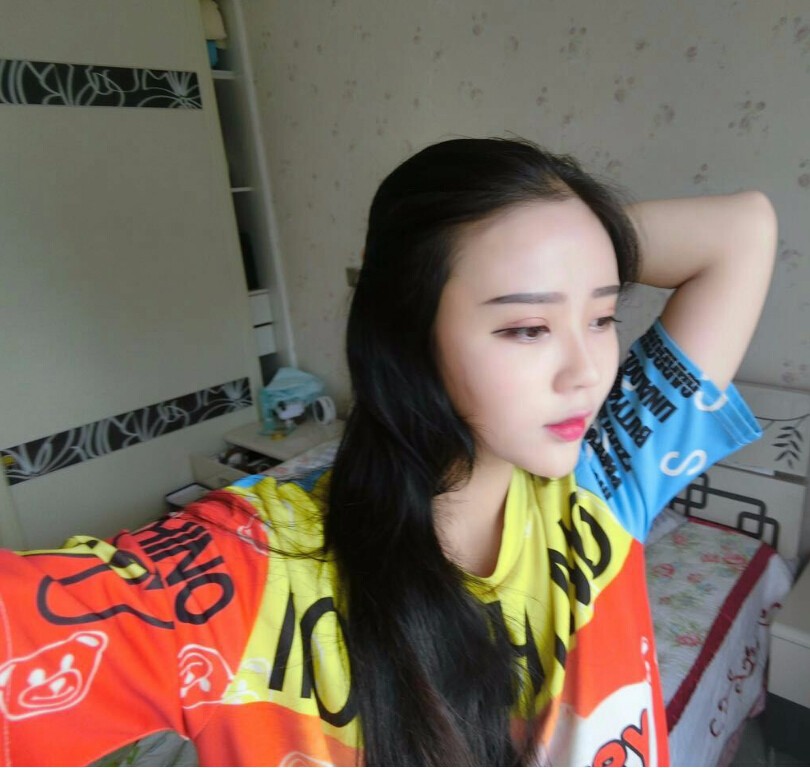 西安華仁醫(yī)院整形美容中心做自體脂肪填充效果怎么樣？附耿延鵬整形案例