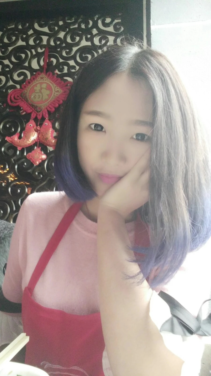 西安米蘭柏羽整形醫(yī)院李旭平做切開雙眼皮效果怎么樣？附案例
