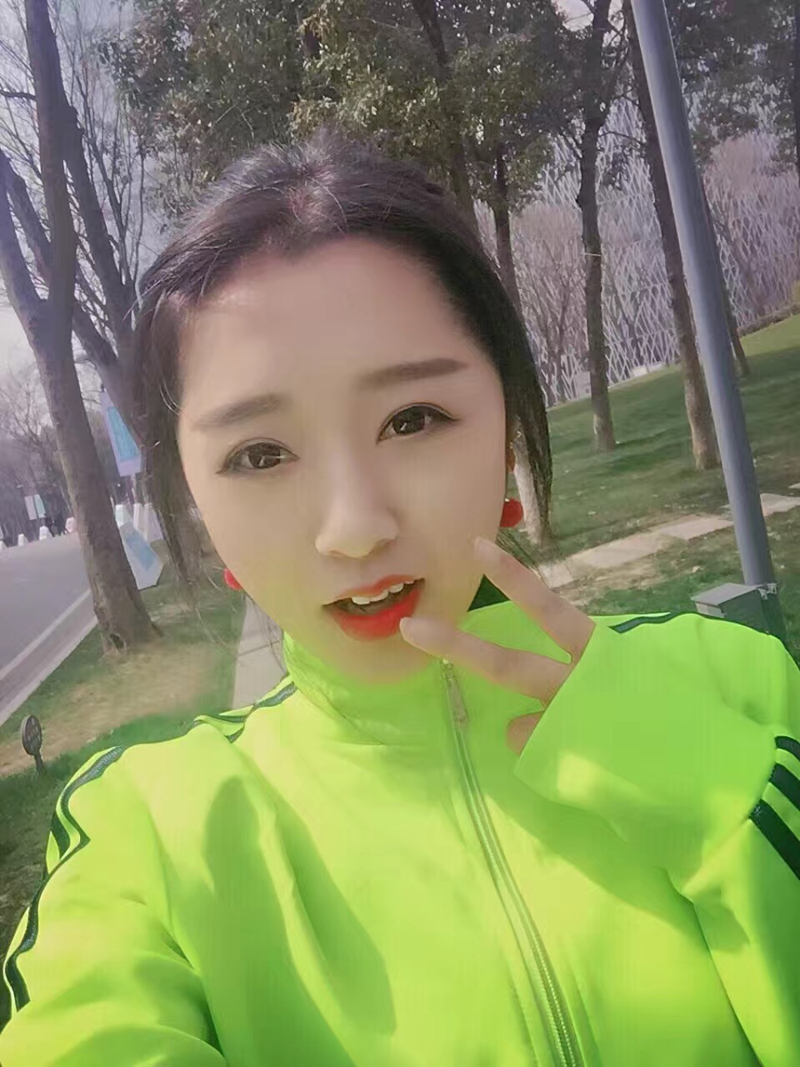 西安米蘭柏羽整形醫(yī)院李旭平做切開雙眼皮效果怎么樣？附案例