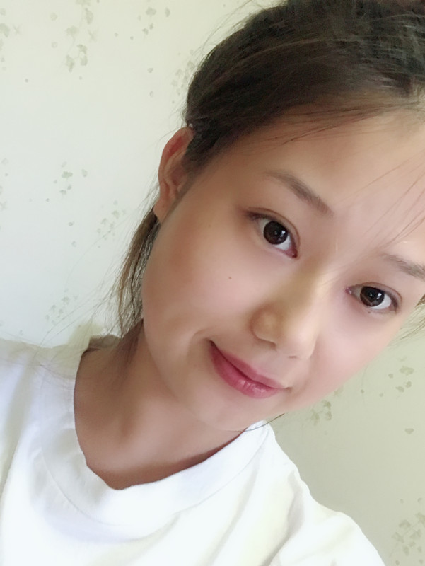 西安藝星整形醫(yī)院徐智慧醫(yī)生做埋線提升怎么樣？附西安藝星埋線提升案例