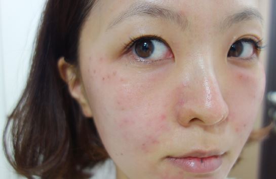 徐州時光洪揚醫(yī)療美容診所宮昔愿醫(yī)生做激光祛斑效果怎么樣？