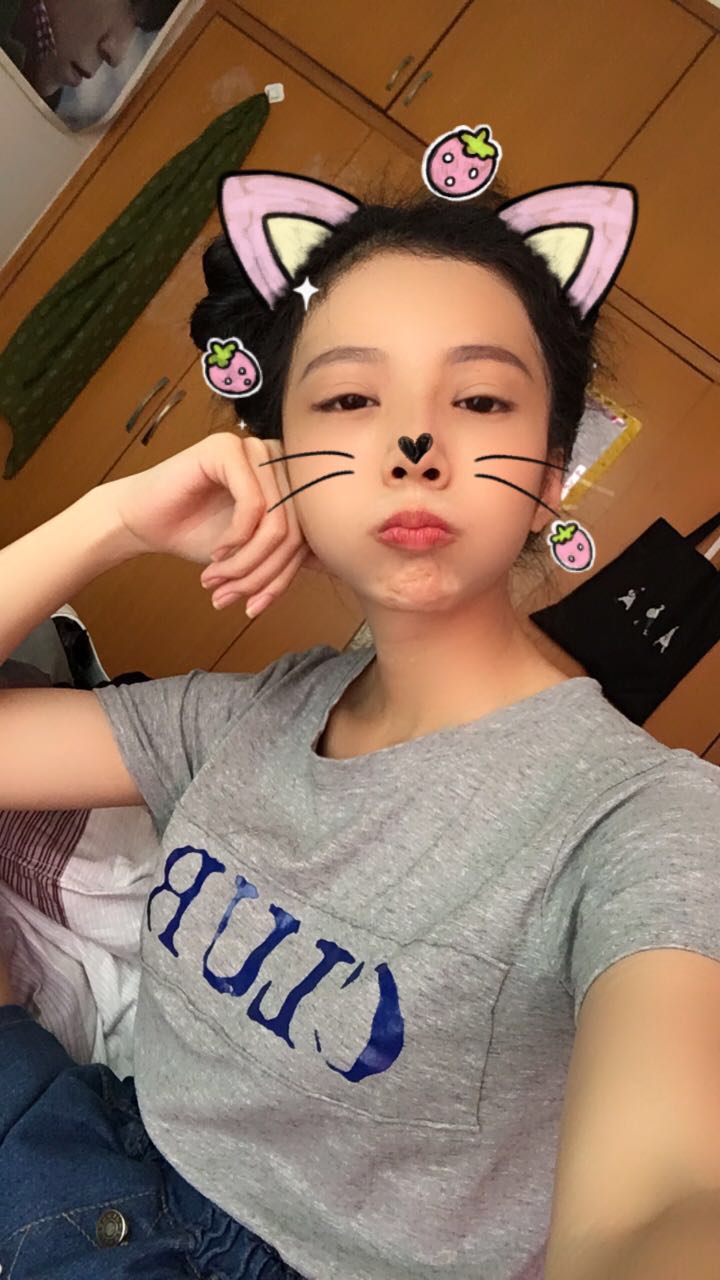 西安高一生醫(yī)療美容醫(yī)院網購恒醫(yī)生做自體脂肪全臉填充案例效果對比圖