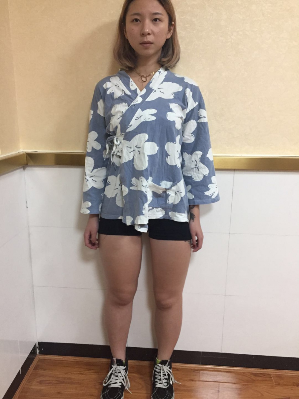 深圳鵬愛(ài)醫(yī)療整形醫(yī)生張建文做大腿吸脂怎么樣？附大腿吸脂案例效果對(duì)比圖