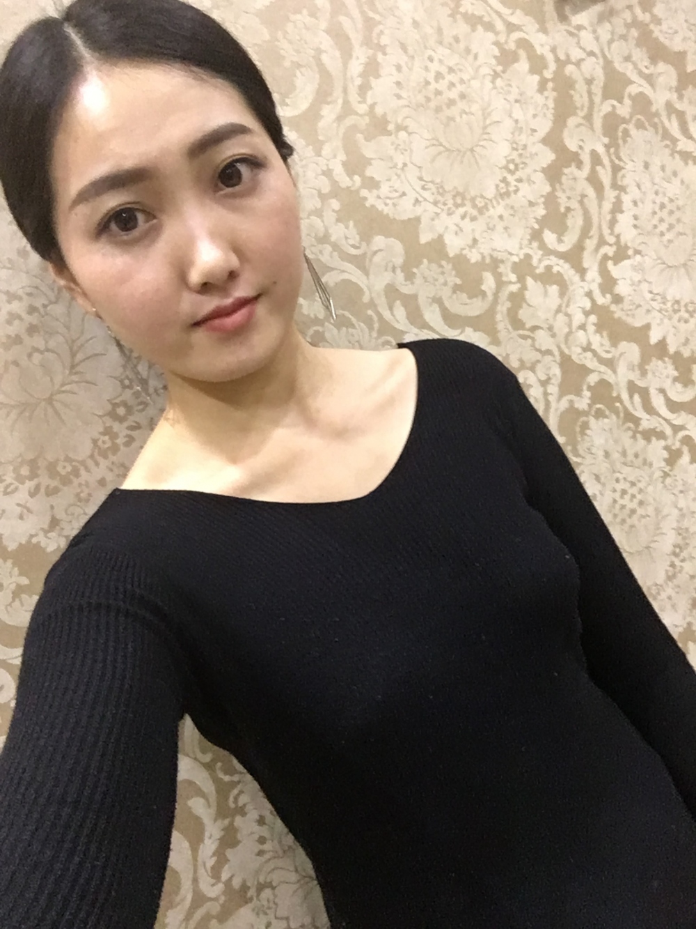 宜春美萊醫(yī)療整形醫(yī)生黃治林做自體脂肪隆胸怎么樣？附案例
