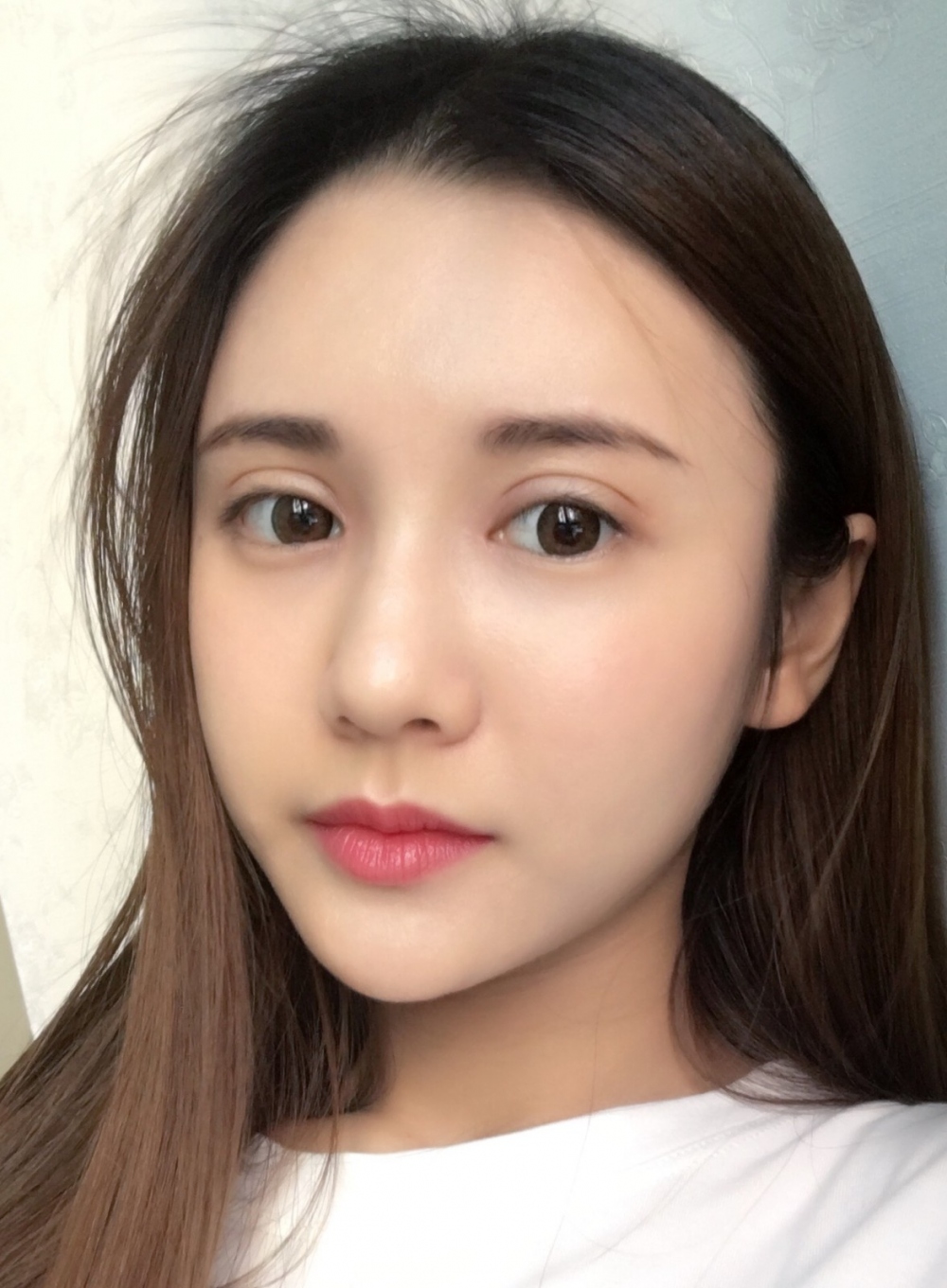 鄭州銘藝整形醫(yī)生陳濤做切開(kāi)雙眼皮怎么樣？鄭州銘藝切開(kāi)雙眼皮案例