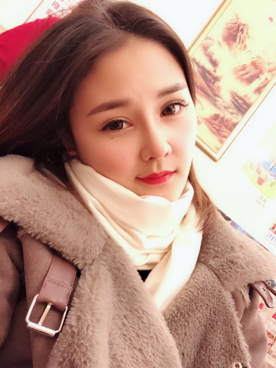 鄭州華領(lǐng)醫(yī)療美容醫(yī)院賀小虎醫(yī)生做眼綜合+鼻部整形手術(shù)效果怎么樣？