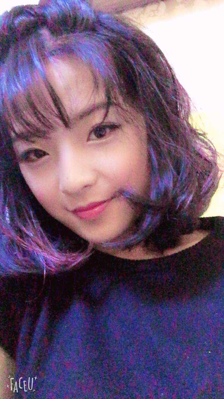 鄭州名門整形醫(yī)院董斌醫(yī)生做下頜角整形怎么樣？附下頜角整形案例