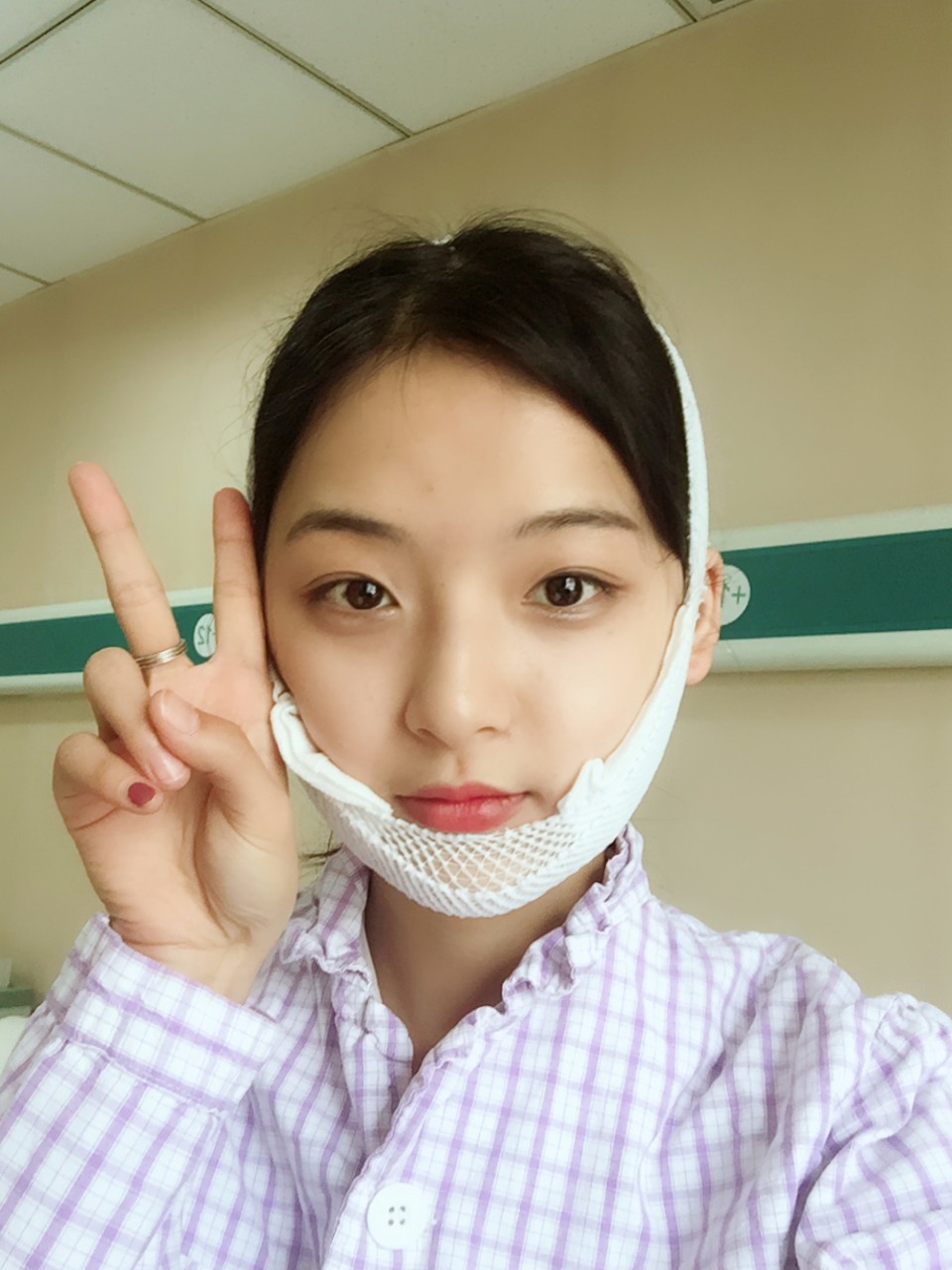 鄭州名門整形醫(yī)院董斌醫(yī)生做下頜角整形怎么樣？附下頜角整形案例