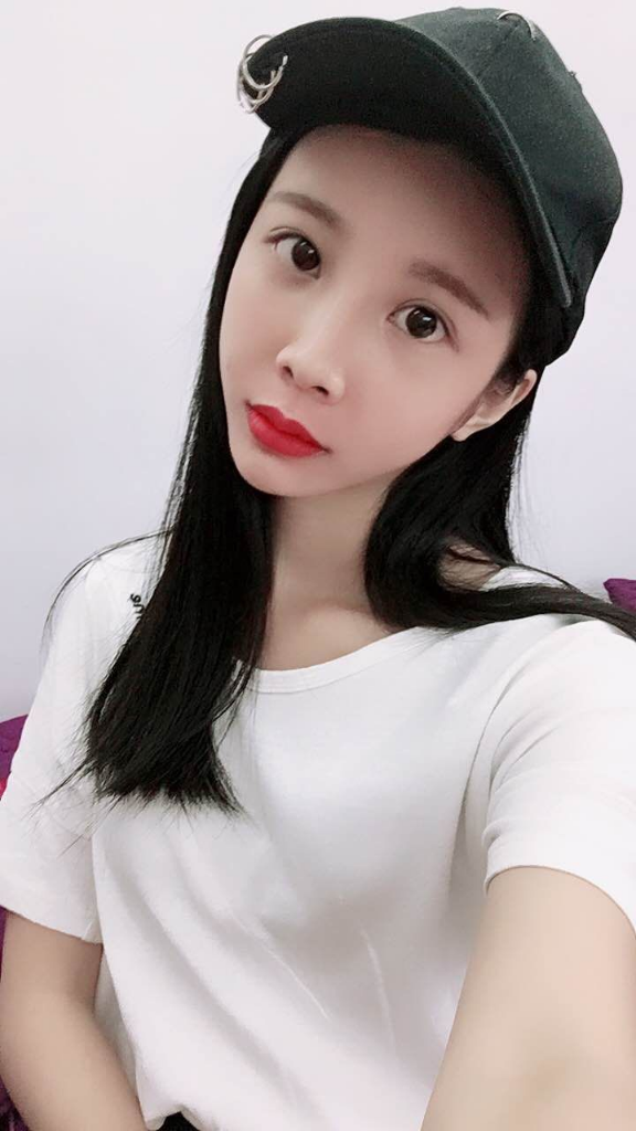 西安高一生醫(yī)療美容醫(yī)院網購恒醫(yī)生做自體脂肪全臉填充案例效果對比圖