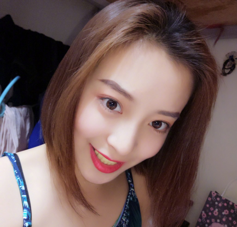 重慶樂樂欣口腔趙麗麗醫(yī)生做冷光美白效果怎么樣？附冷光美白效果對比圖