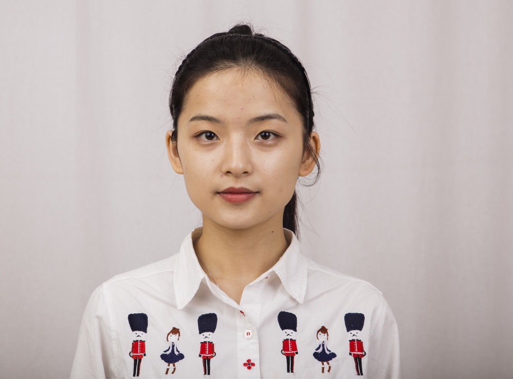 鄭州名門整形醫(yī)院董斌醫(yī)生做下頜角整形怎么樣？附下頜角整形案例