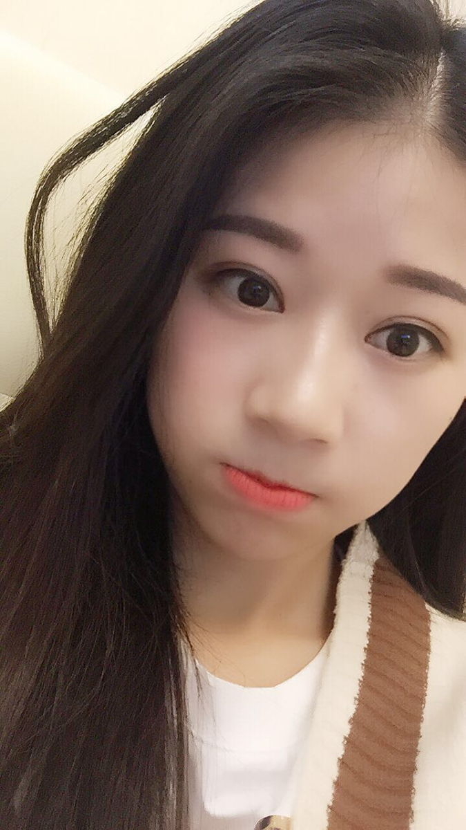 深圳晨曦醫(yī)療整形醫(yī)生吉米斯做切開(kāi)雙眼皮怎么樣？吉米斯切開(kāi)雙眼皮案例效果