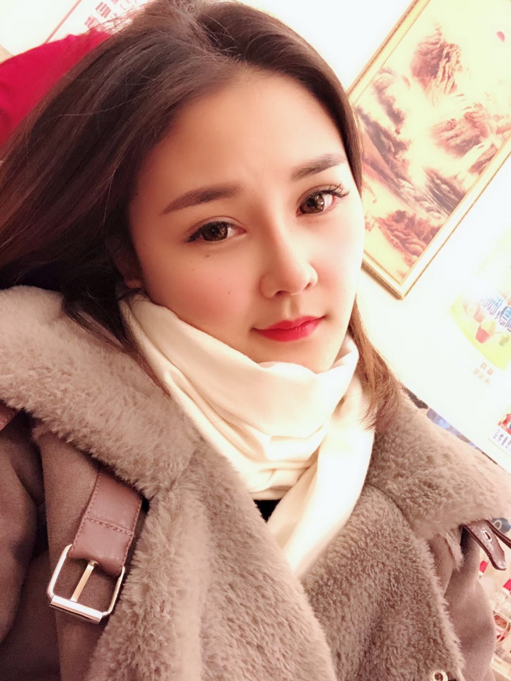 鄭州華領(lǐng)醫(yī)療美容醫(yī)院賀小虎醫(yī)生做眼綜合+鼻部整形手術(shù)效果怎么樣？