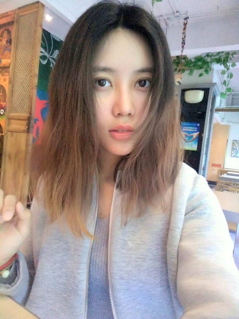 重慶美圣美邦整形醫(yī)院劉力維醫(yī)生做自體脂肪全臉填充案例效果對比圖