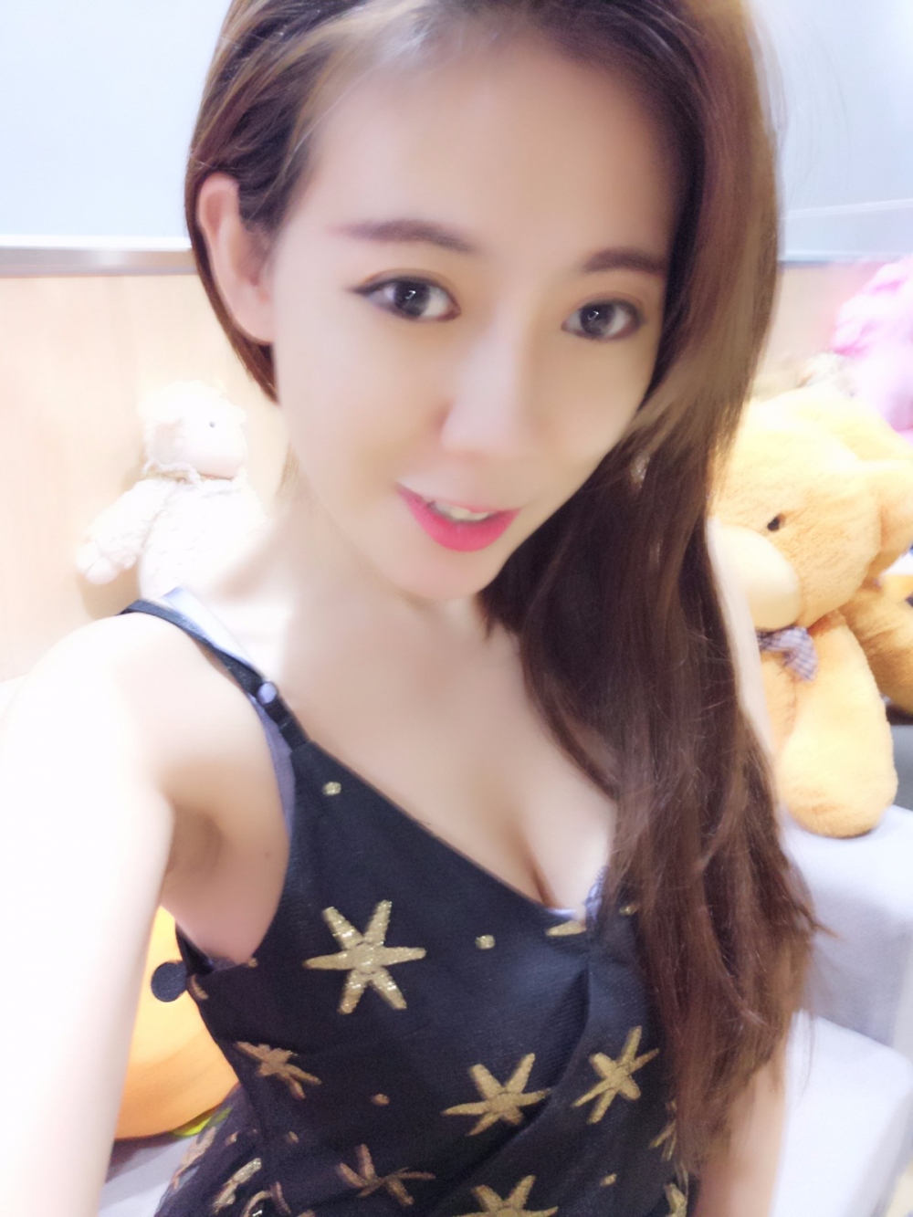 煙臺(tái)壹美整形醫(yī)院朱建瑩醫(yī)生做自體脂肪隆胸怎么樣？附自體脂肪隆胸案例