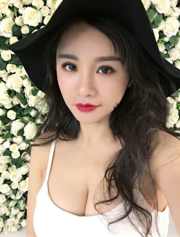海南韓美醫(yī)學美容醫(yī)院李強醫(yī)生做自體脂肪隆胸效果怎么樣？附案例