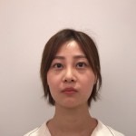 天津歐華威莎整形醫(yī)生姚玲做面部埋線提升效果怎么樣？附埋線提升案例