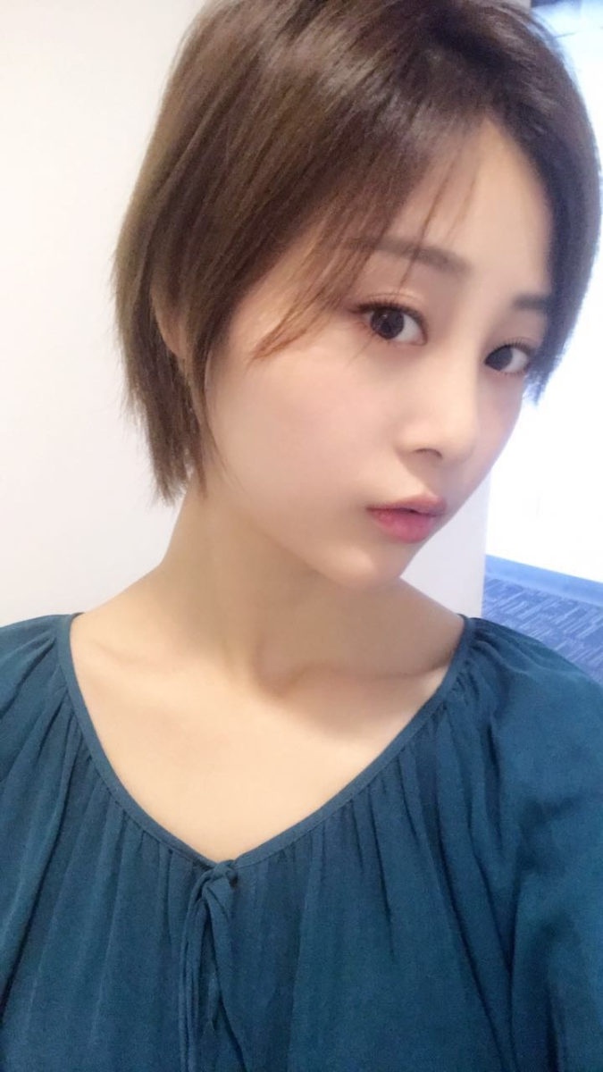 天津歐華威莎整形醫(yī)生姚玲做面部埋線提升效果怎么樣？附埋線提升案例