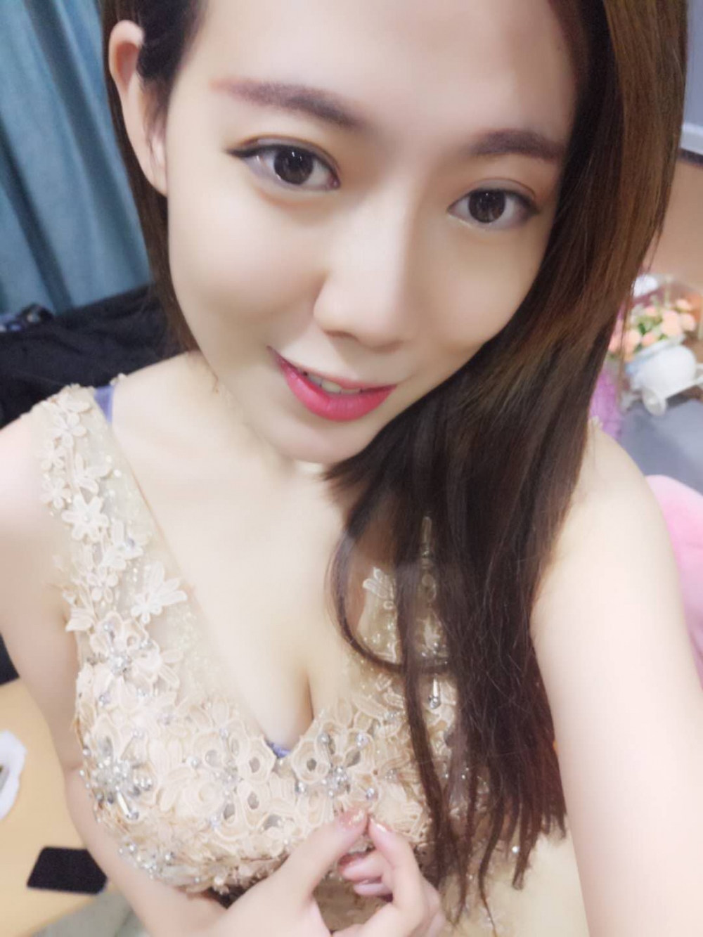 煙臺(tái)壹美整形醫(yī)院朱建瑩醫(yī)生做自體脂肪隆胸怎么樣？附自體脂肪隆胸案例
