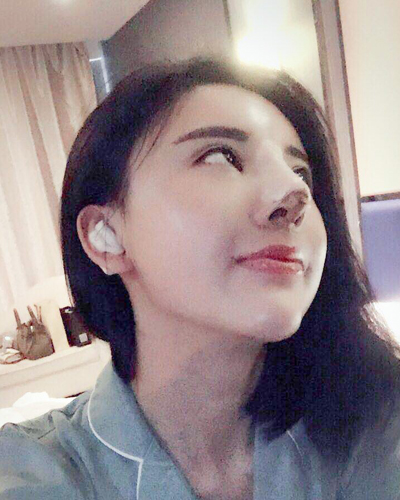 襄陽維多利亞整形醫(yī)院安邰晥醫(yī)生做鼻綜合整形怎么樣？附鼻綜合整形案例