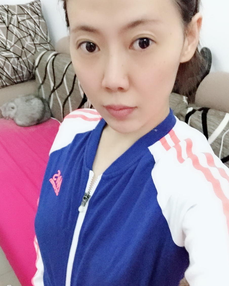煙臺壹美整形醫(yī)院朱建瑩醫(yī)生做自體脂肪隆胸怎么樣？附自體脂肪隆胸案例