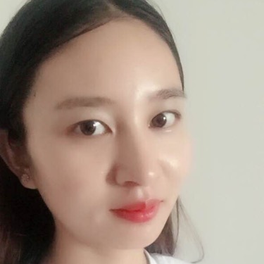 武漢維納斯整形醫(yī)院趙瑾醫(yī)生做玻尿酸墊下巴怎么樣？附玻尿酸墊下巴案例