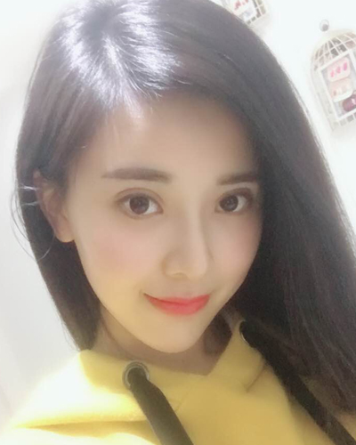襄陽維多利亞整形醫(yī)院安邰晥醫(yī)生做鼻綜合整形怎么樣？附鼻綜合整形案例