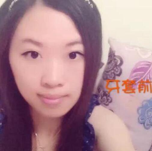 重慶嘉悅口腔醫(yī)院周繼祥醫(yī)生做金屬托槽矯正效果怎么樣？附案例效果對(duì)比圖
