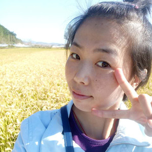 珠海蒂伊醫(yī)療整形醫(yī)生廖俊凱做激光祛斑效果怎么樣？附激光祛斑案例效果圖