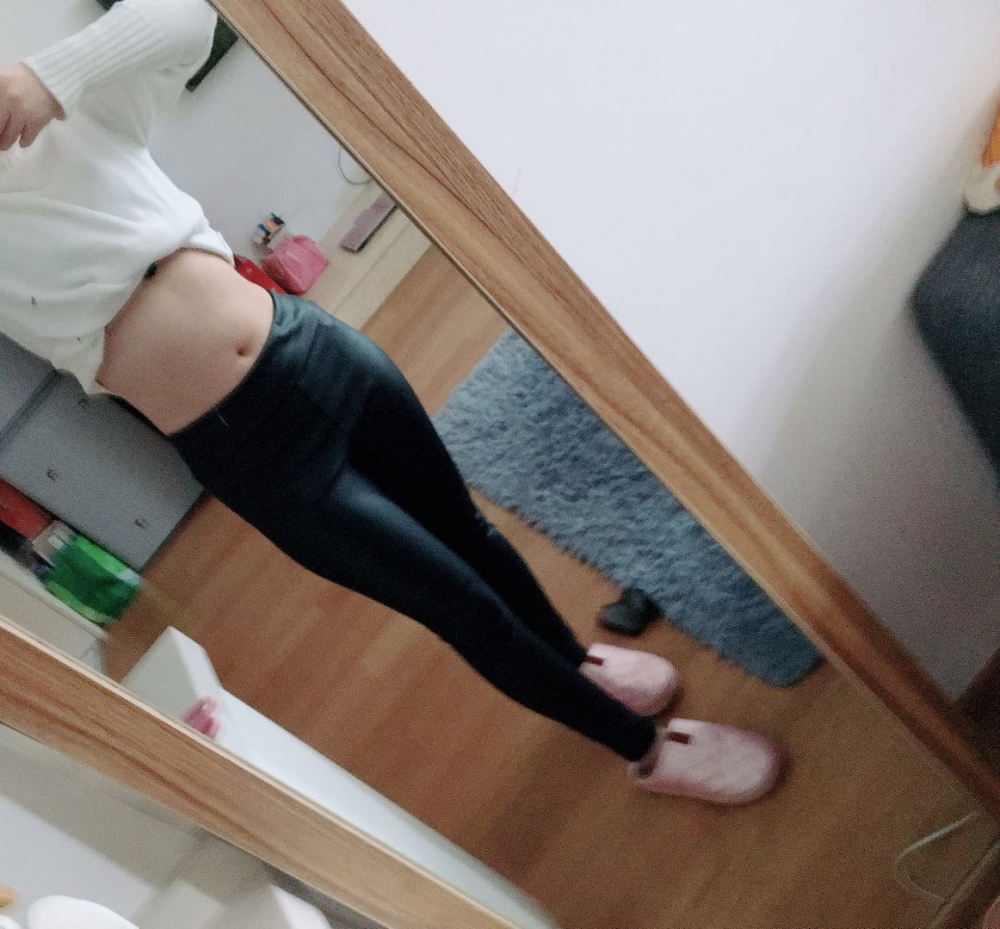 肇慶華美整形醫(yī)院陳巍醫(yī)生做腰腹吸脂效果怎么樣？附腰腹吸脂案例