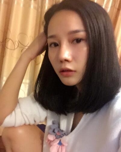 西安陽光整形醫(yī)院邵萍醫(yī)生做鼻綜合整形怎么樣？附鼻綜合整形案例