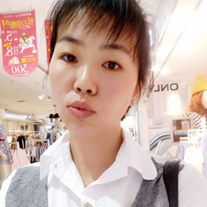 珠海蒂伊醫(yī)療整形醫(yī)生廖俊凱做激光祛斑效果怎么樣？附激光祛斑案例效果圖