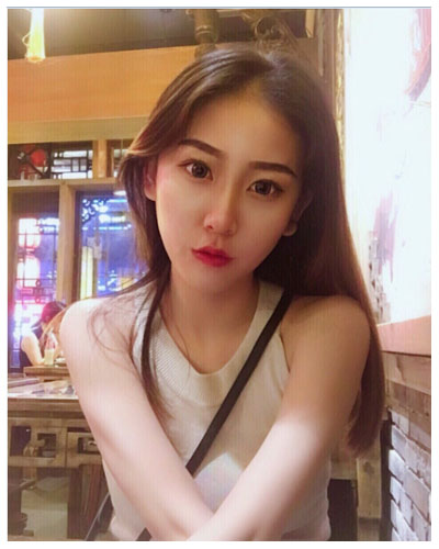 珠海海大整形美容外科黃發(fā)醫(yī)生做面部吸脂怎么樣？附面部吸脂案例