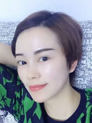 西安壹加壹整形醫(yī)院劉晨醫(yī)生做點(diǎn)陣激光祛痘效果怎么樣？附點(diǎn)陣激光祛痘效果圖