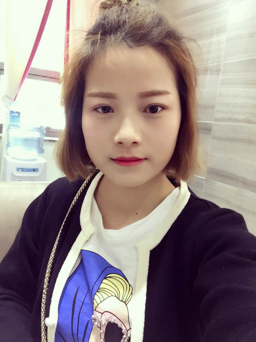 西安藝星醫(yī)療整形醫(yī)院李國玲做鼻綜合整形怎么樣？附李國玲鼻綜合整形案例