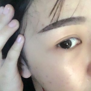 大同清木整形醫(yī)院張樹霞醫(yī)生做半永久紋眉效果如何？附半永久紋眉效果圖