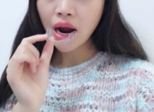 廈門拜博口腔醫(yī)院醫(yī)生張忠做牙齒隱形矯正怎么樣？附案例效果對比圖